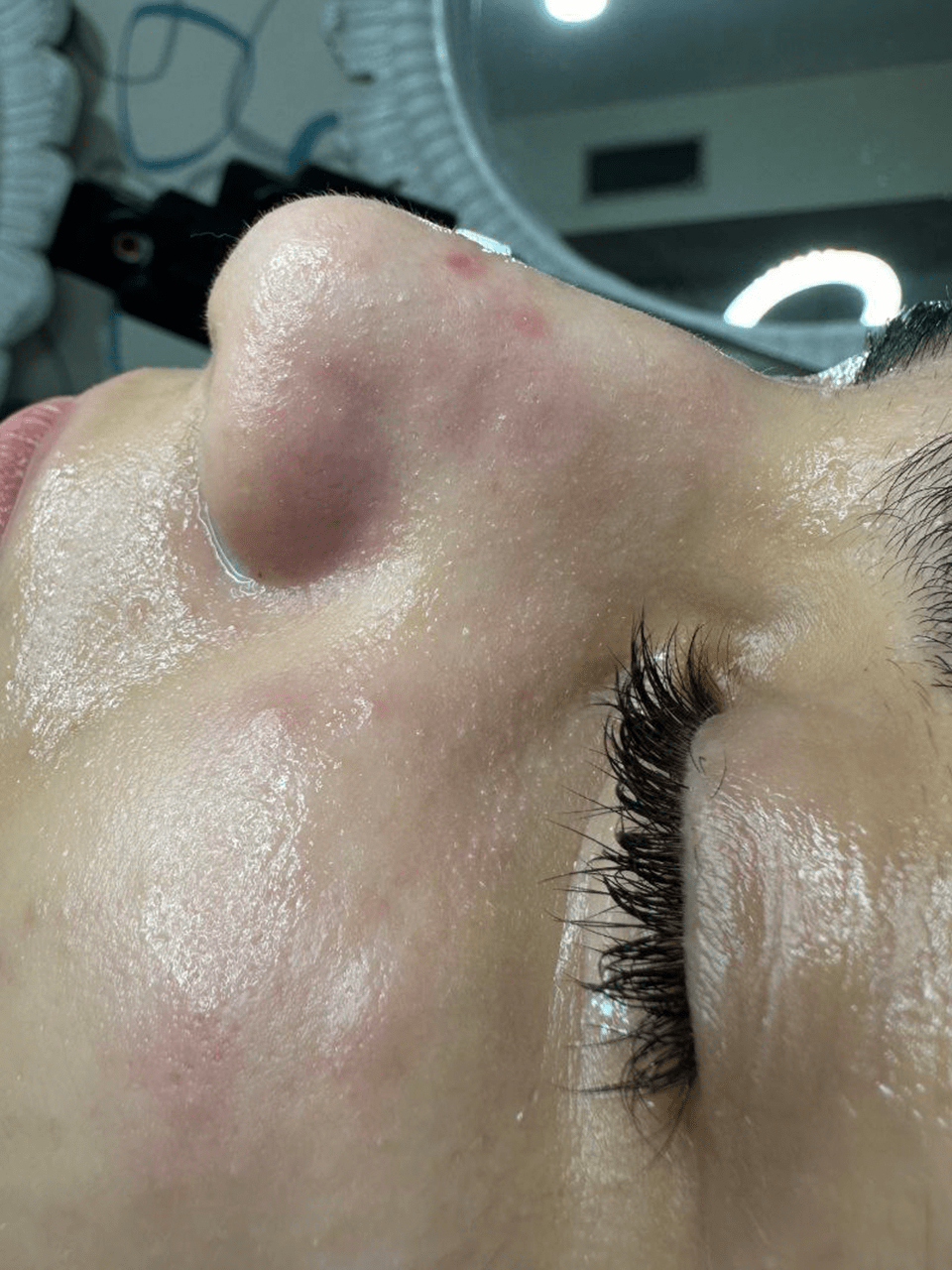 نمونه کار پاکسازی پوست و فیشیال | سیما زارع